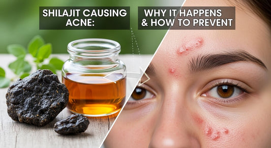 Shilajit Causing Acne: Why It Happens & How to Prevent